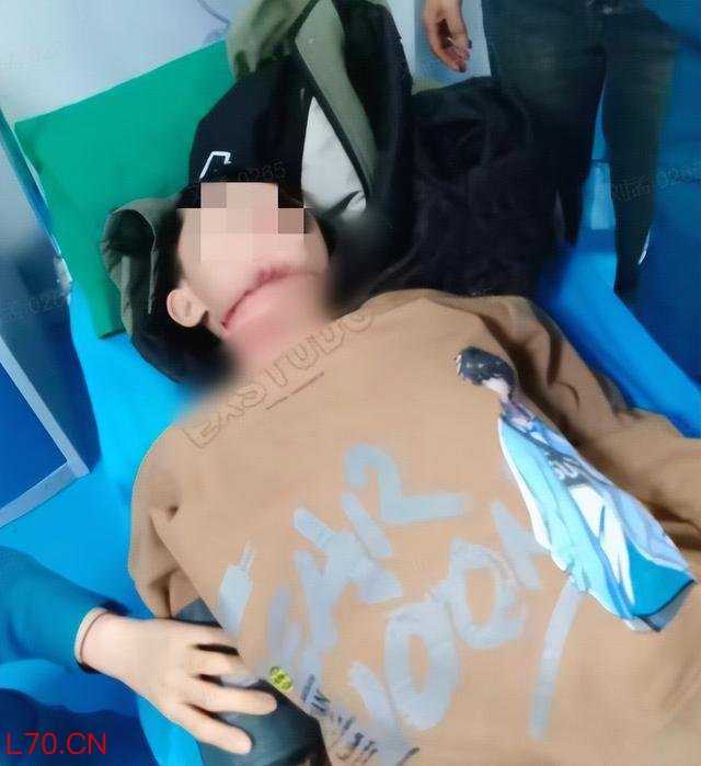 遭割喉男孩仍有一段气管未找到